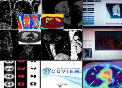 خبرنگاران فناوران اردبیلی سامانه هوشمند پردازش تصاویر پزشکی ساختند
